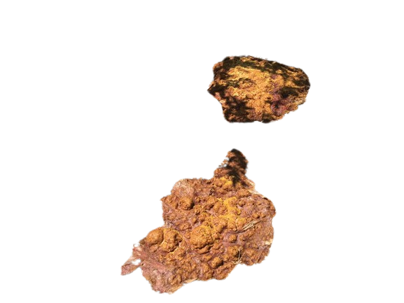 brown vomit