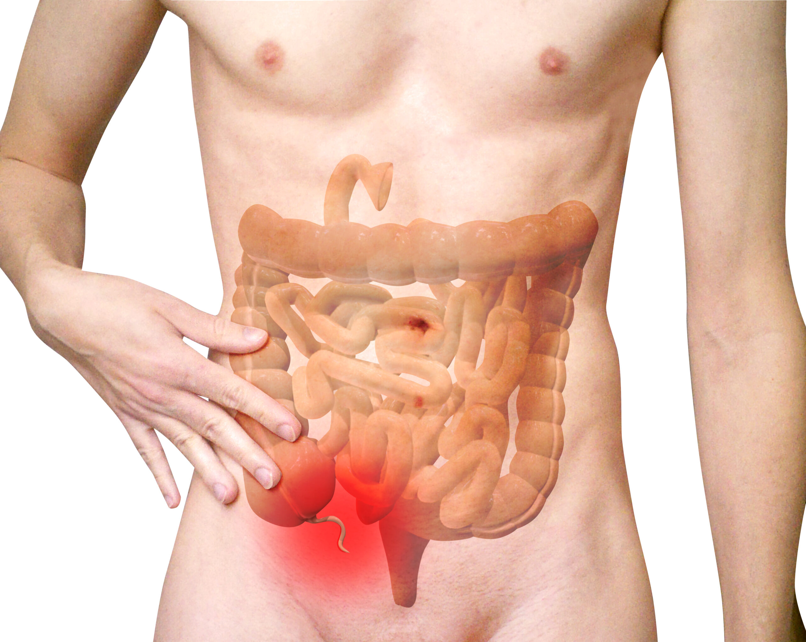 appendicitis vomiting